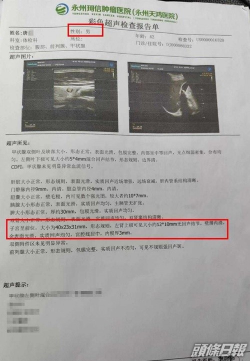 出錯的體檢報告清楚列出唐男「有子宮」及其檢查結果。網上圖片