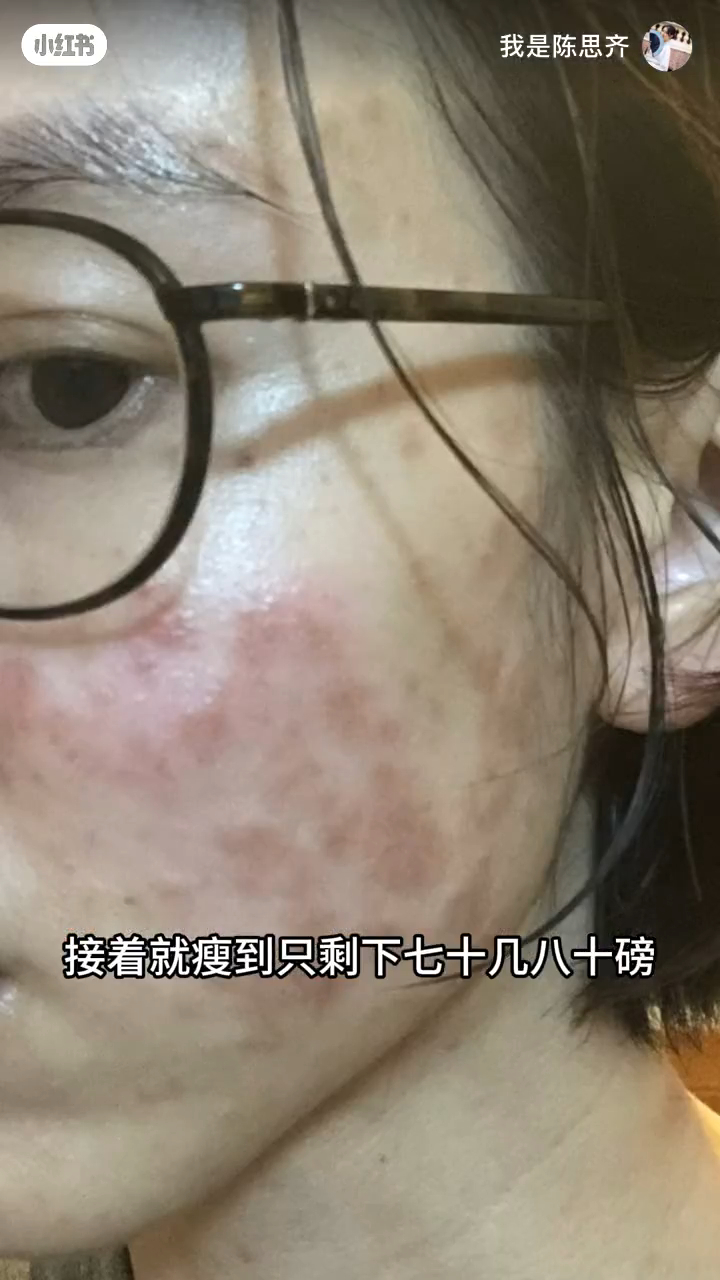 陳思齊俏臉大面積變黑。