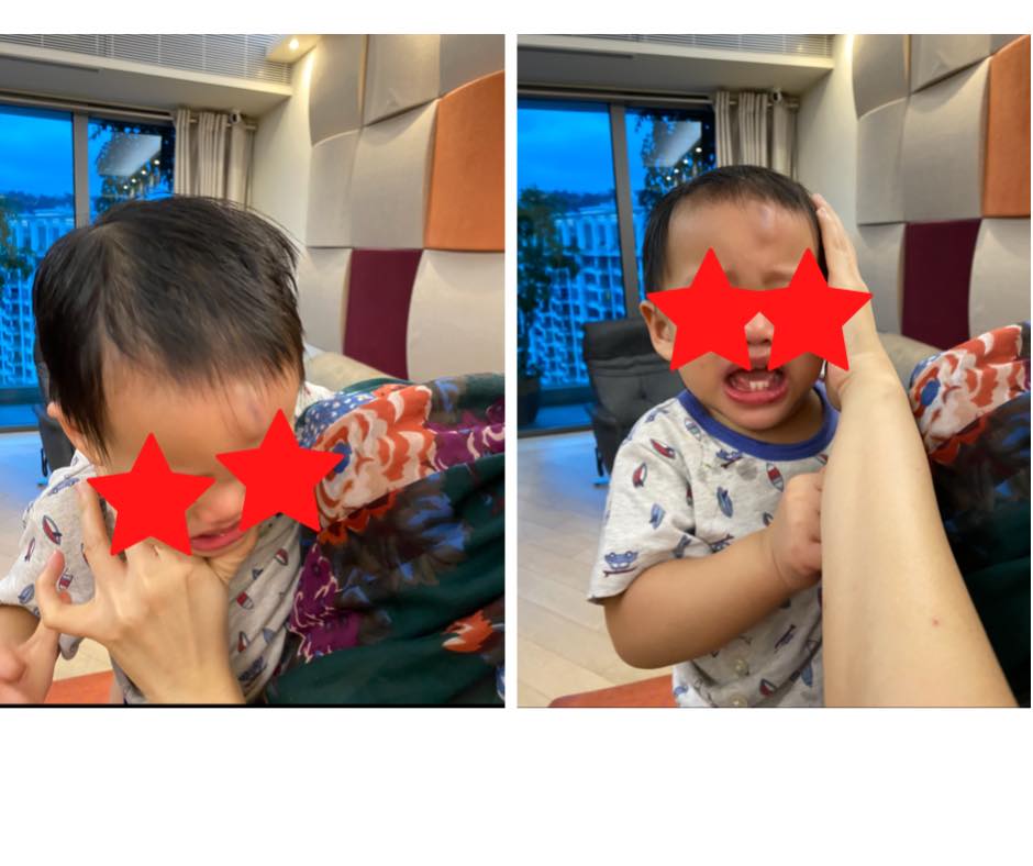 外傭卻突然縮腳致幼子跌倒額頭腫起。 網民Csw Csf Chan 圖片