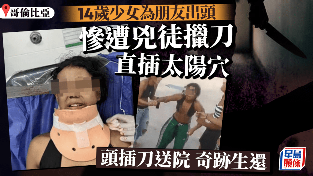 驚慄械鬥|14歲少女為朋友出頭 遭兇徒刀插太陽穴奇跡生還