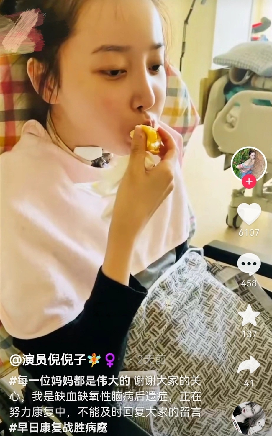 凭着惊人毅力，经长达3年的艰辛复健，她终于在2025年4月重新迈出独立行走的步伐，并于同年底恢复基本自理能力。