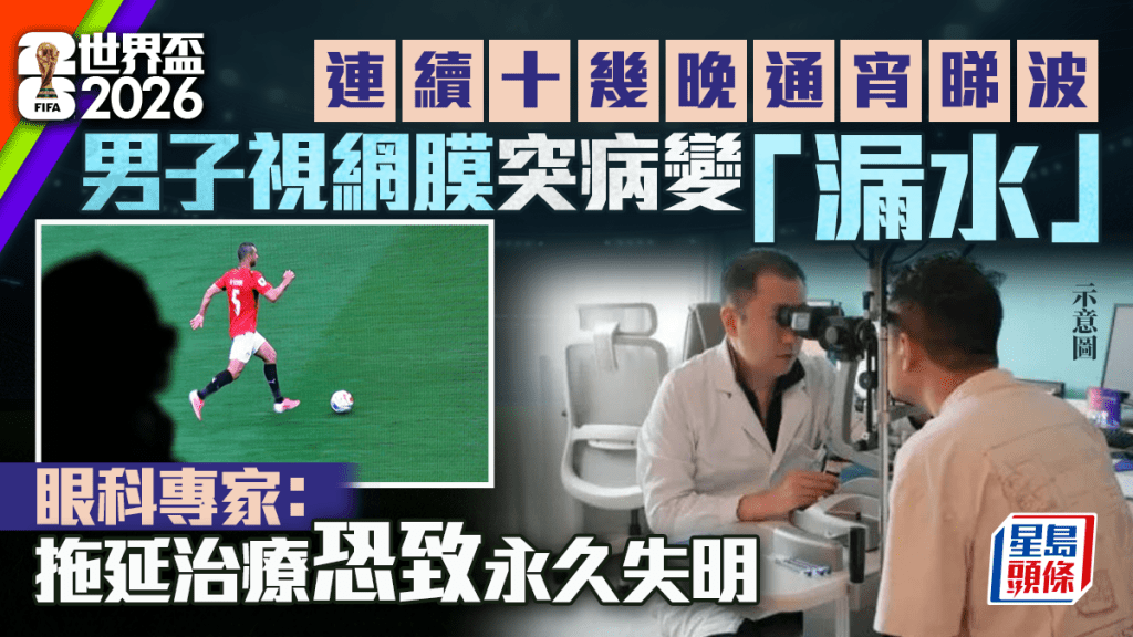 世界杯2026︱东莞男连续十多晚通宵睇波险盲  左眼视网膜突病变「漏水」