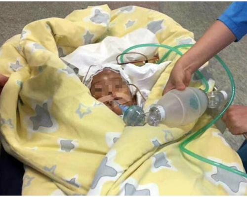 被虐待2歲男童,至今仍生命垂危。網圖