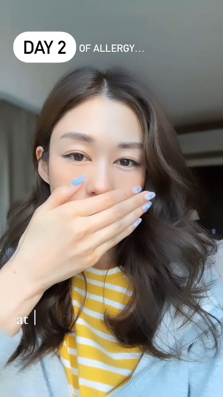 岑丽香于IG限时动态分享自拍影片，因过敏导致双唇突然肿胀。