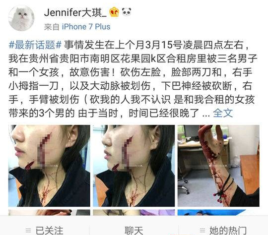 受害女子劉雪琪,在微博留言講述了自己可怕的遭遇。(網圖)