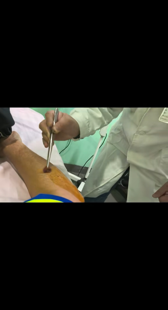 90年代大俠自曝健康亮紅燈粗針穿臂畫面曝光66歲有前列腺肥大肺部病變問題