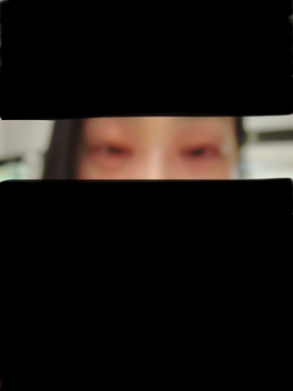 郭柏妍因為嚴重食物敏感,令面容腫得面目全非。 郭柏妍因為嚴重食物敏感,令面容腫得面目全非。