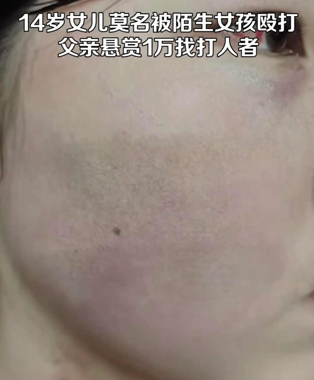 网红爸爸发片显示女儿伤势。