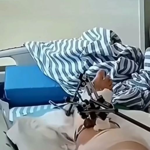 江西婦人由12樓墜地奇蹟生還。抖音＠齊齊哈爾交通廣播