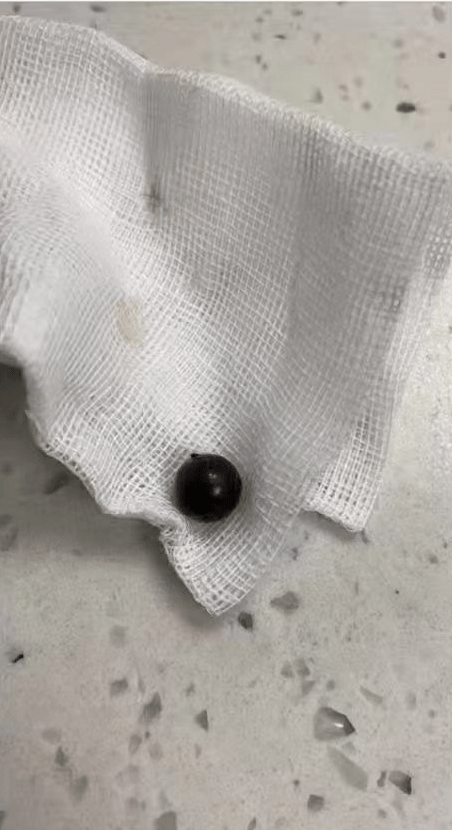 取出的鋼珠。 取出的鋼珠。