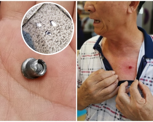 老翁遭「痰罐仔」射傷胸口。