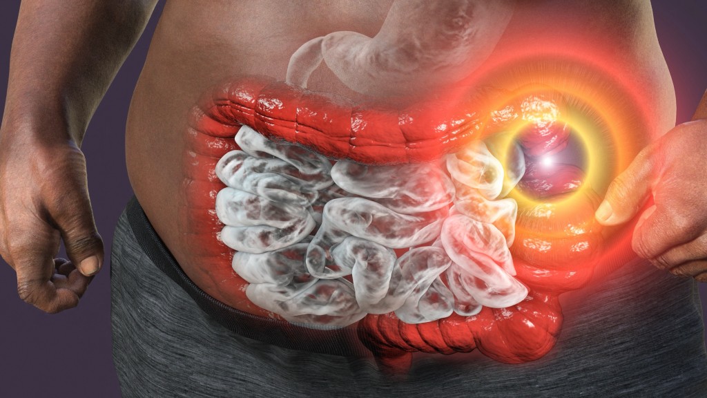 便秘慘劇｜美國身障男子痛苦1個月無人幫，9公斤大便塞爆腸亡。 法新社示意圖