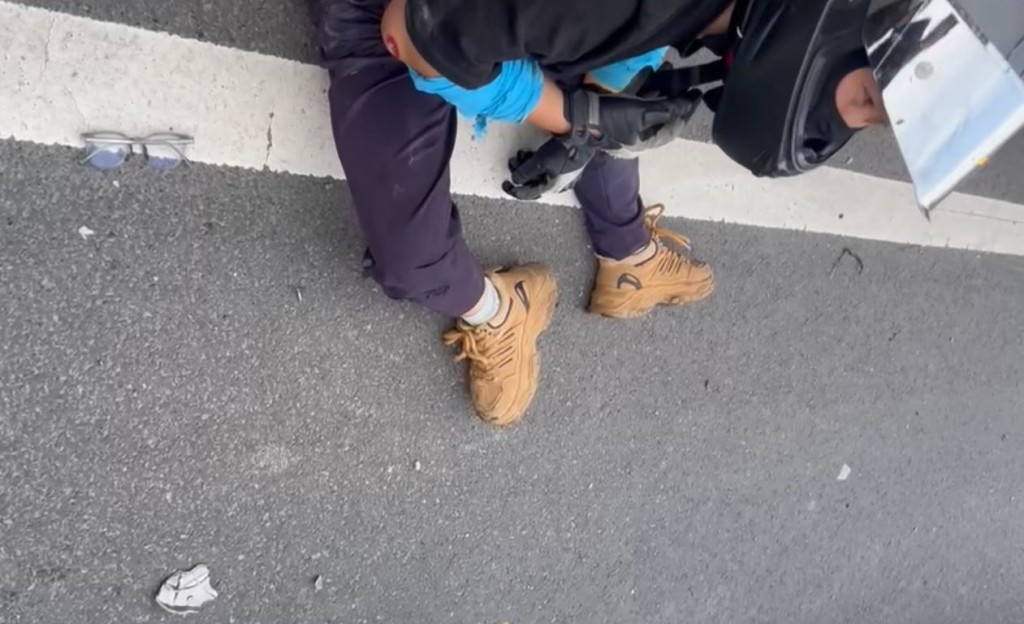 電單車司機手臂被撞至骨折。抖音＠項少.玩機車