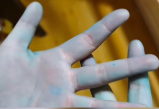 自製網紅美食「牛癟火鍋」，成都一家4口吃完雙手變藍中毒送院。