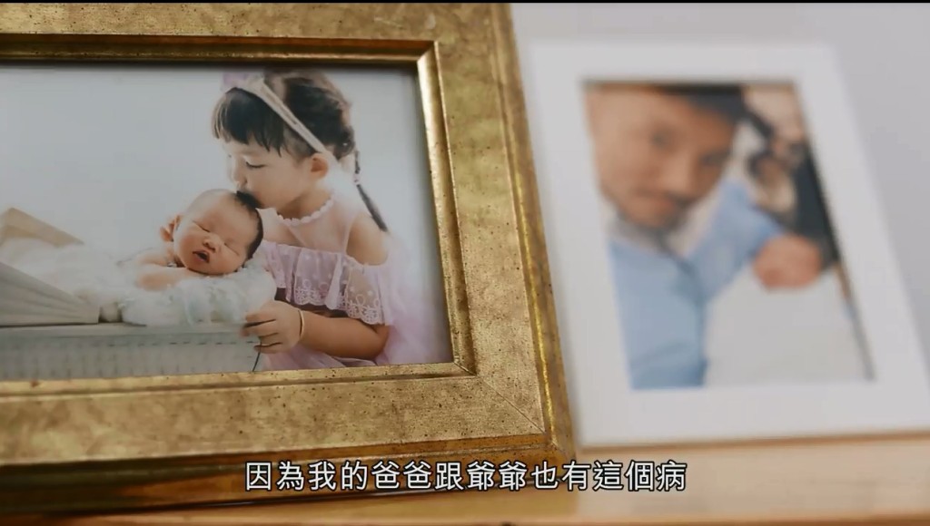 張穎康曾擔心銀屑病會傳給下一代。(香港銀屑病友會，銀屑護關會 截圖)