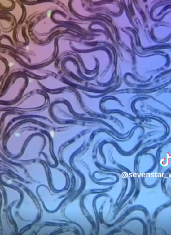 洗水塔公司在显微镜下检视污水，发现不同形态的微生物。
