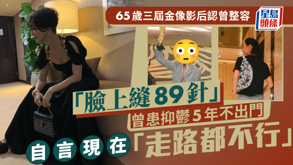 65歲三屆金像影后認曾整容「臉上縫89針」  曾患抑鬱5年不出門  自言現在「走路都不行」