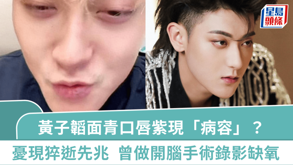 黃子韜面青口唇紫現「病容」？粉絲憂現猝逝先兆  「百億富二代」曾做開腦手術錄影缺氧