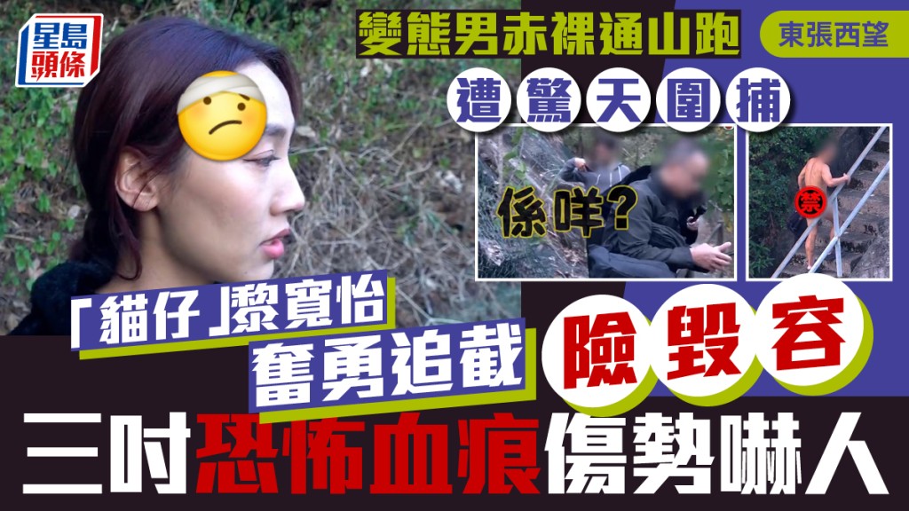 東張西望｜變態男赤裸通山跑遭驚天圍捕  「貓仔」黎寬怡奮勇追截險毀容  三吋恐怖血痕傷勢嚇人