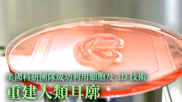 美國有研究團隊利用病人細胞及3D植入技術，重建人類耳朵。網上圖片