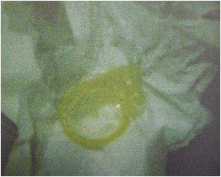 女童吐出一個用過的保險套。網圖