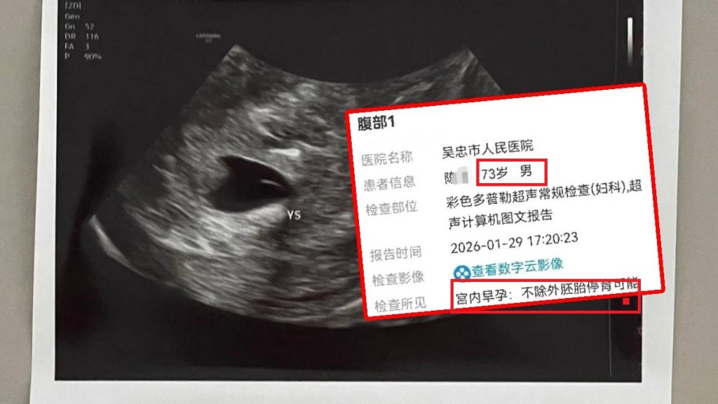 寧夏有73歲翁心臟不適求醫，但醫院檢查報告顯示：宮內早孕。示意圖。