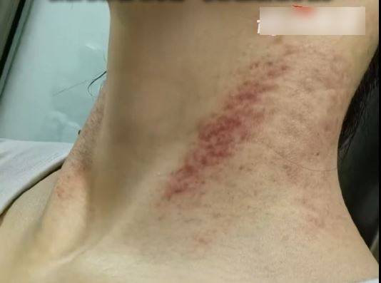 西安女護士董某某生前長期被同居男友家暴。新聞夜航 西安女護士董某某生前長期被同居男友家暴。新聞夜航