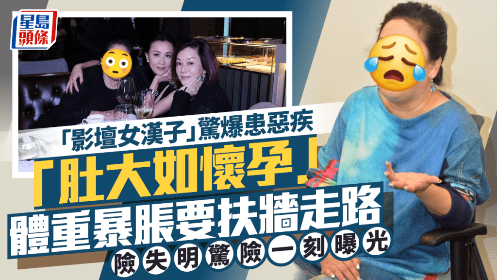 「影坛女汉子」惊爆患恶疾「肚大如怀孕」体重暴胀   扶墙走路险失明惊险一刻曝光