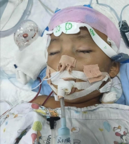 生父女友頻繁施以虐待，包括毆打其背部、臀部、腿部，以及用牙齒啃咬其腿部。