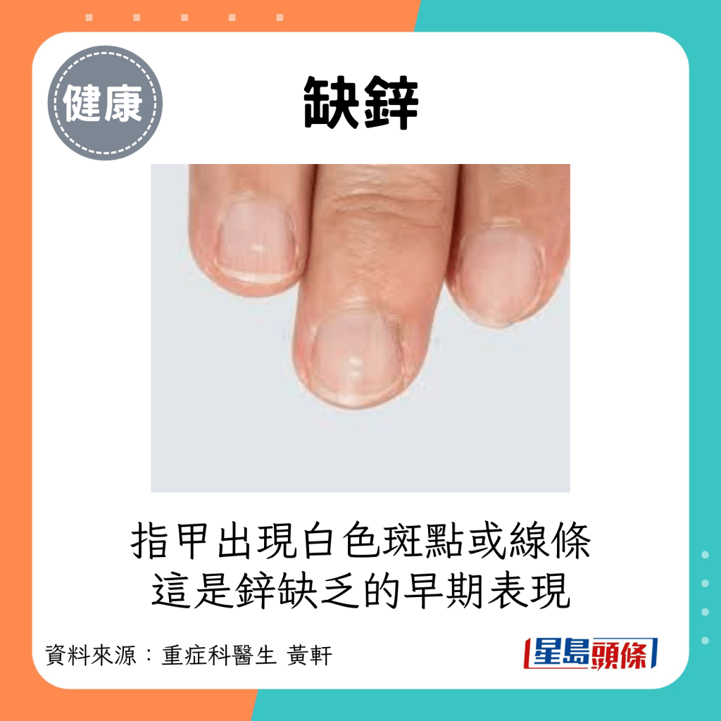 缺锌：指甲出现白色斑点或线条