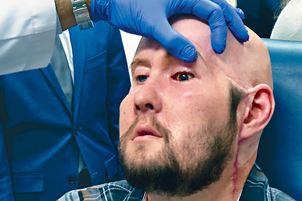 詹姆斯上月23日在紐約接受主診醫生檢查。