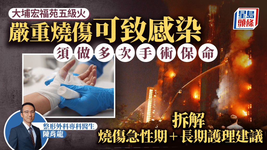 大埔宏福苑五級火｜嚴重燒傷可致感染須做多次手術保命  醫生教燒傷急性期處理方法+長期護理建議
