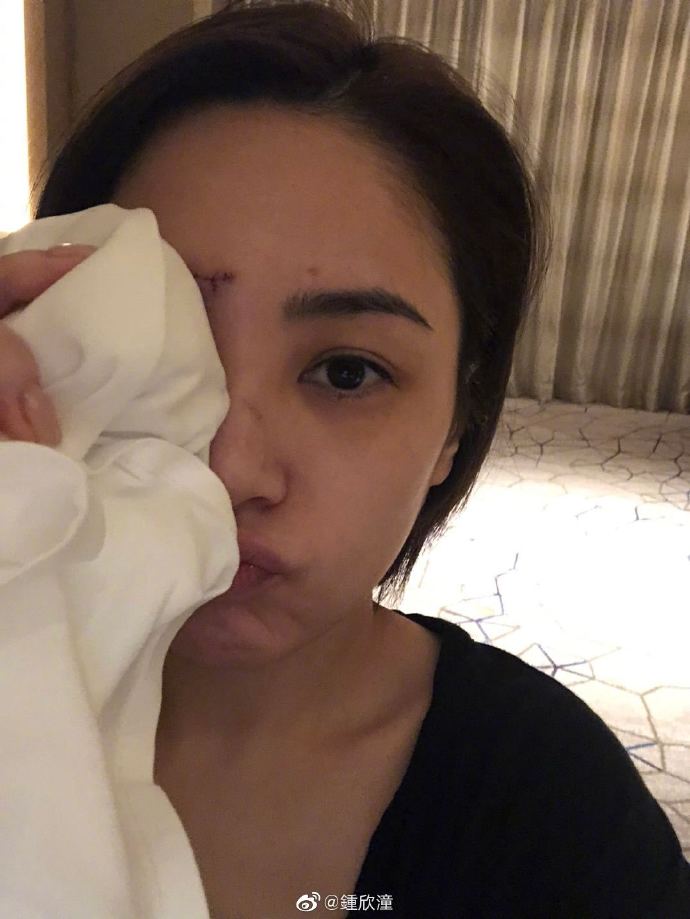 阿嬌之前說傷口恢復情況良好。