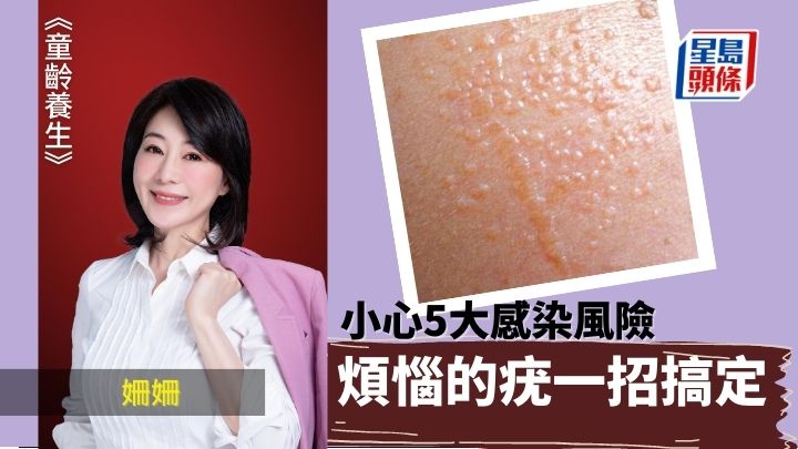 生疣問題一招搞定 小心5大感染風險｜童齡養生