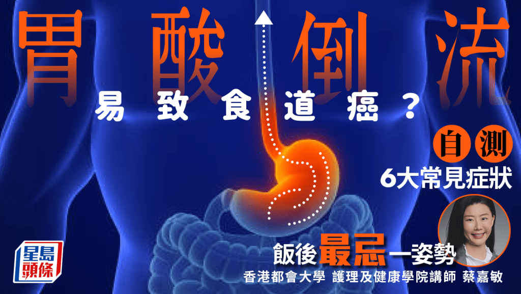 胃酸倒流易致食道癌？專家教自測6大常見症狀 飯後最忌一姿勢