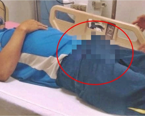 越南一名男子因喝下3枝壯陽藥，而導致出現終生性功能勃起障礙。網圖
