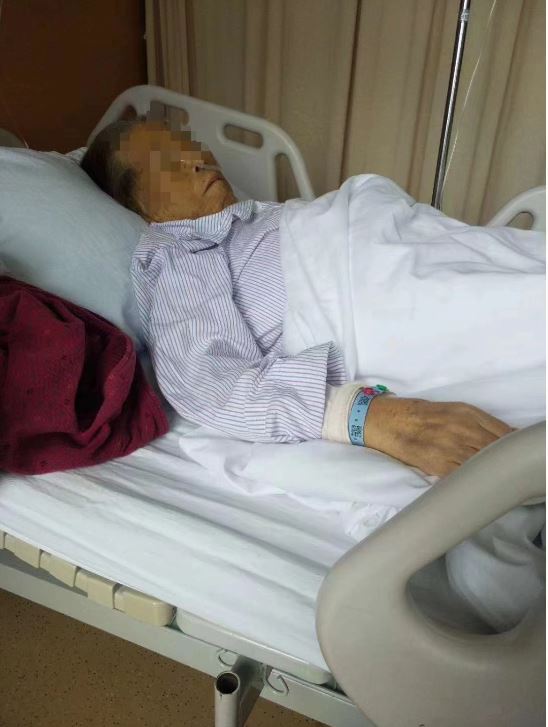 77岁的张玉华在无肿瘤下被施“全胰切除术”，术后两个月离世。