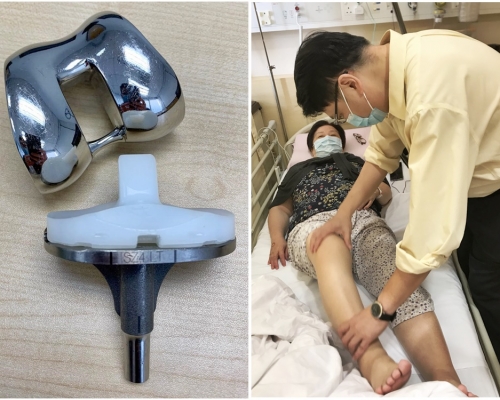 圖左：人工關節。圖右：張堅穎為病人作手術前檢查。相片由寶血醫院（明愛）提供

