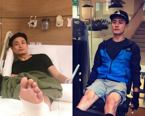 Bosco腳傷仍未痊癒已經開始健身操腿。黃宗澤ig