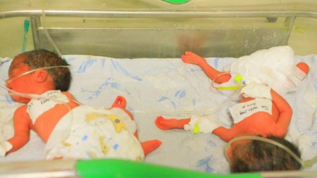 4男1女寶寶體重介乎1.3至1.4公斤，非常健康。 Hiwot Fana Specialised Hospital
