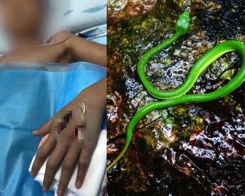 13歲男生網購竹葉青蛇當寵物被咬險送命。