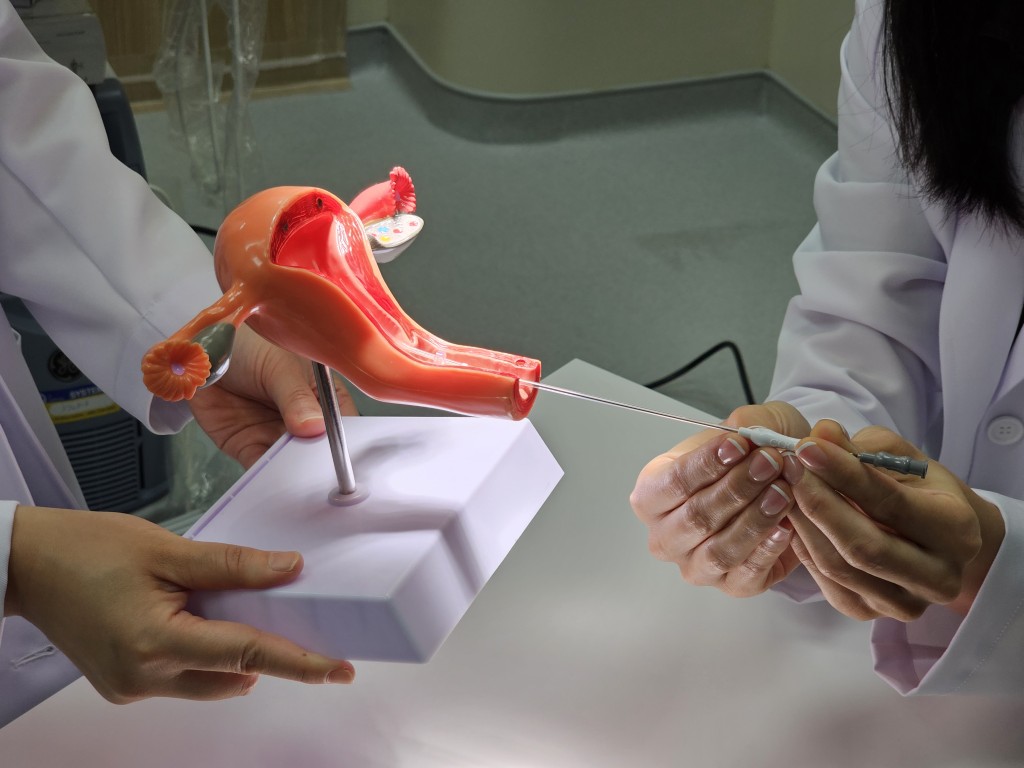 雪卵雪精｜醫生利用儀器及子宮模型示範胚胎植入過程（圖片由希愈醫療提供）