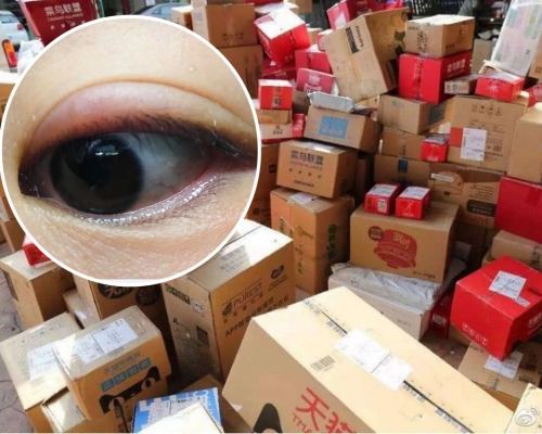 網民指收取包裹時捽了一下眼，即使眼紅腫多時。