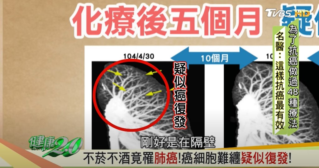 蔡松彥懷疑全素飲食導致其癌症復發。（《健康2.0》影片截圖）