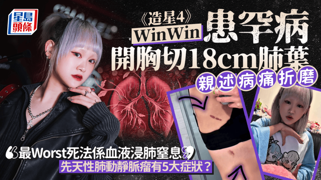 《造星4》WinWin患罕病开胸切18cm肺叶  亲述病痛折磨  「最Worst死法系血液浸肺窒息」 