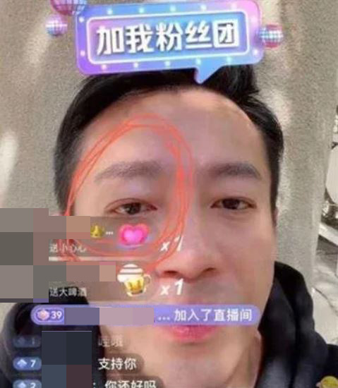 汪小菲開直播澄清，但網民發現他眼腫腫。