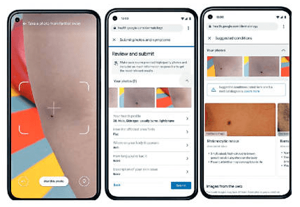 Google Health皮膚科:診斷皮膚問題不求人,Google利用約65,000張去識別化的圖像及經診斷的皮膚狀況病例數據、數百萬張有皮膚問題的圖像,數以千計的健康皮膚例子,開發和調整此AI模型。 Google Health皮膚科:診斷皮膚問題不求人,Google利用約65,000張去識別化的圖像及經診斷的皮膚狀況病例數據、數百萬張有皮膚問題的圖像,數以千計的健康皮膚例子,開發和調整此AI模型。