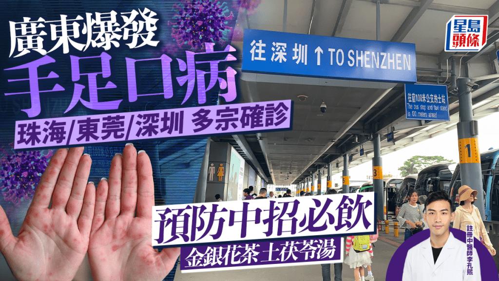 北上注意｜广东爆发手足口病 珠海/东莞/深圳多宗确诊 中医教煲茶饮汤水助预防