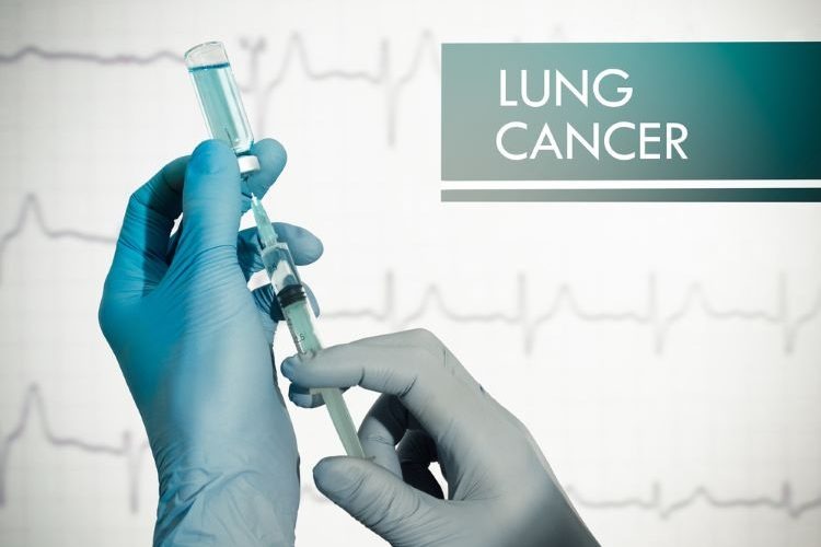 肺癌疫苗能激活免疫系统，杀死癌细胞。网图