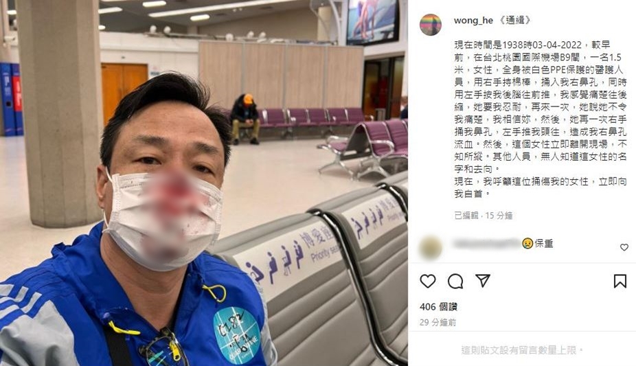 王喜在IG留言講述事發經過。